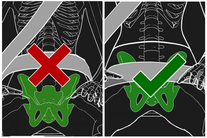 RIKTIG BELTEBRUK: Bilbeltet skal ligge langt nede på magen, over hoftene. Foto: Statens havarikommisjon